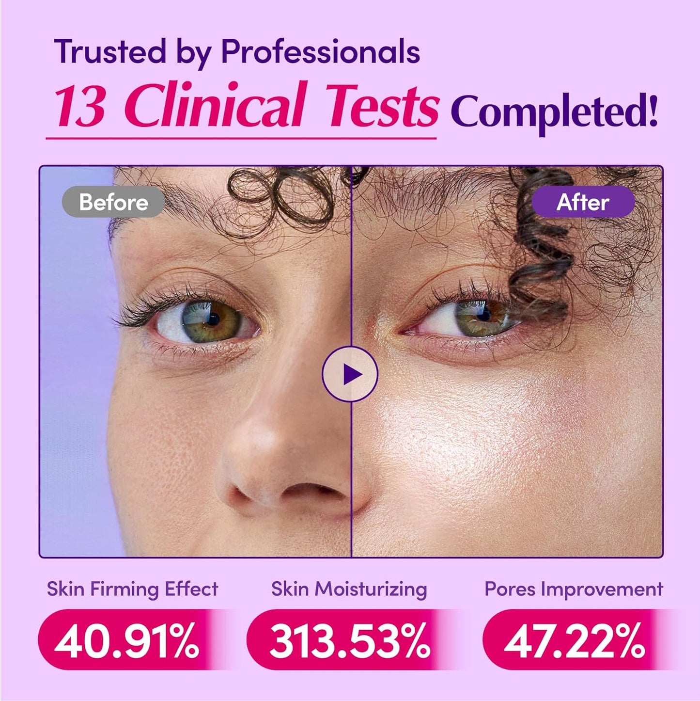 Bakuchiol Plumping Face Serum - Retinol Natural Alternative for Sensitive Skin, with Niacinamide & Hyaluronic Acid, Pore & Wrinkle Korean Skin Care (1.01Oz / 30Ml)